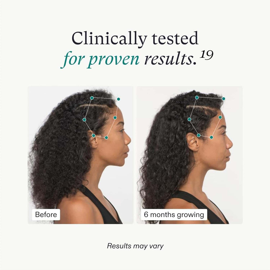 Nutrafol Women's Vegan Hair Growth Supplement Pack 3-Month Supply