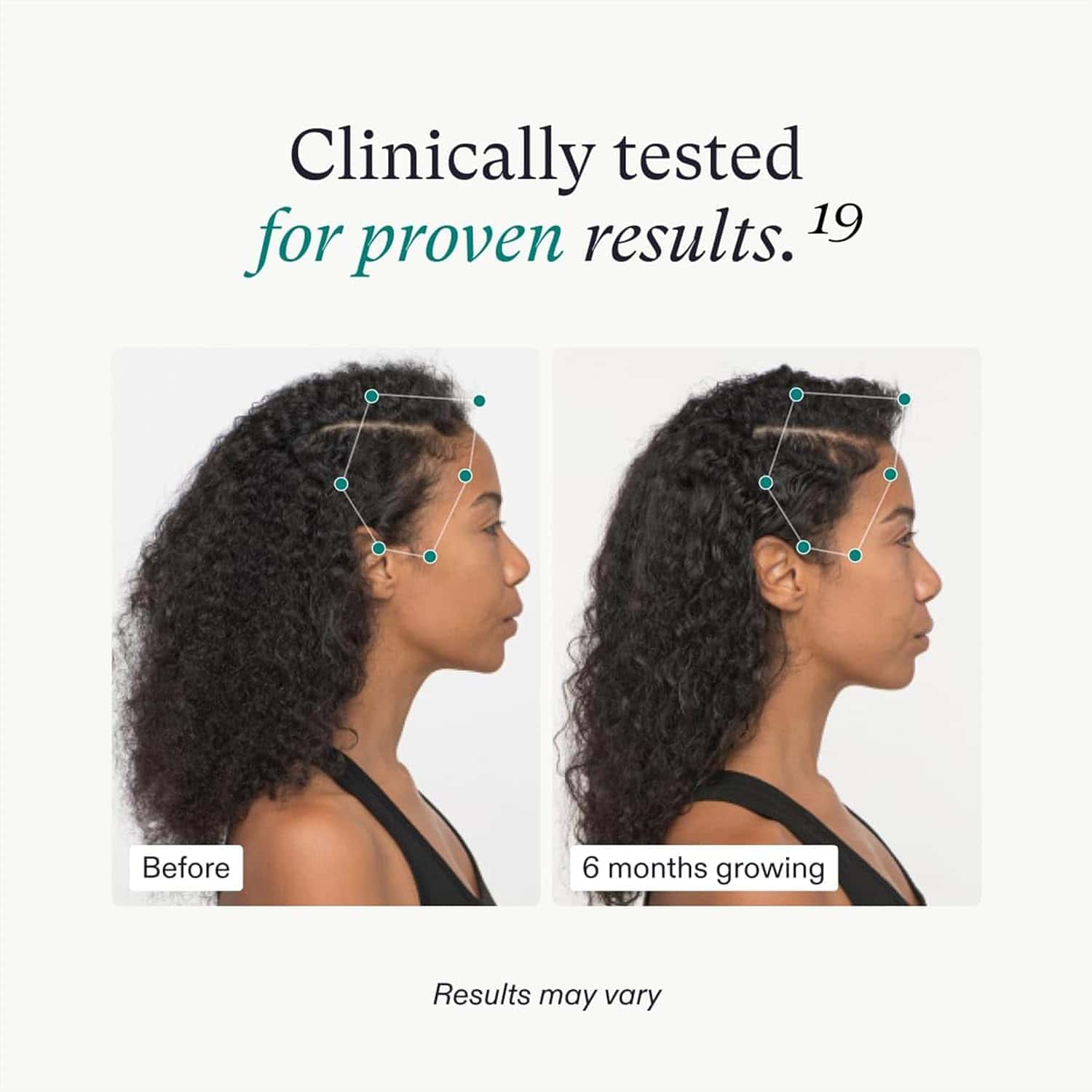 Nutrafol Women's Vegan Hair Growth Supplement Pack 3-Month Supply